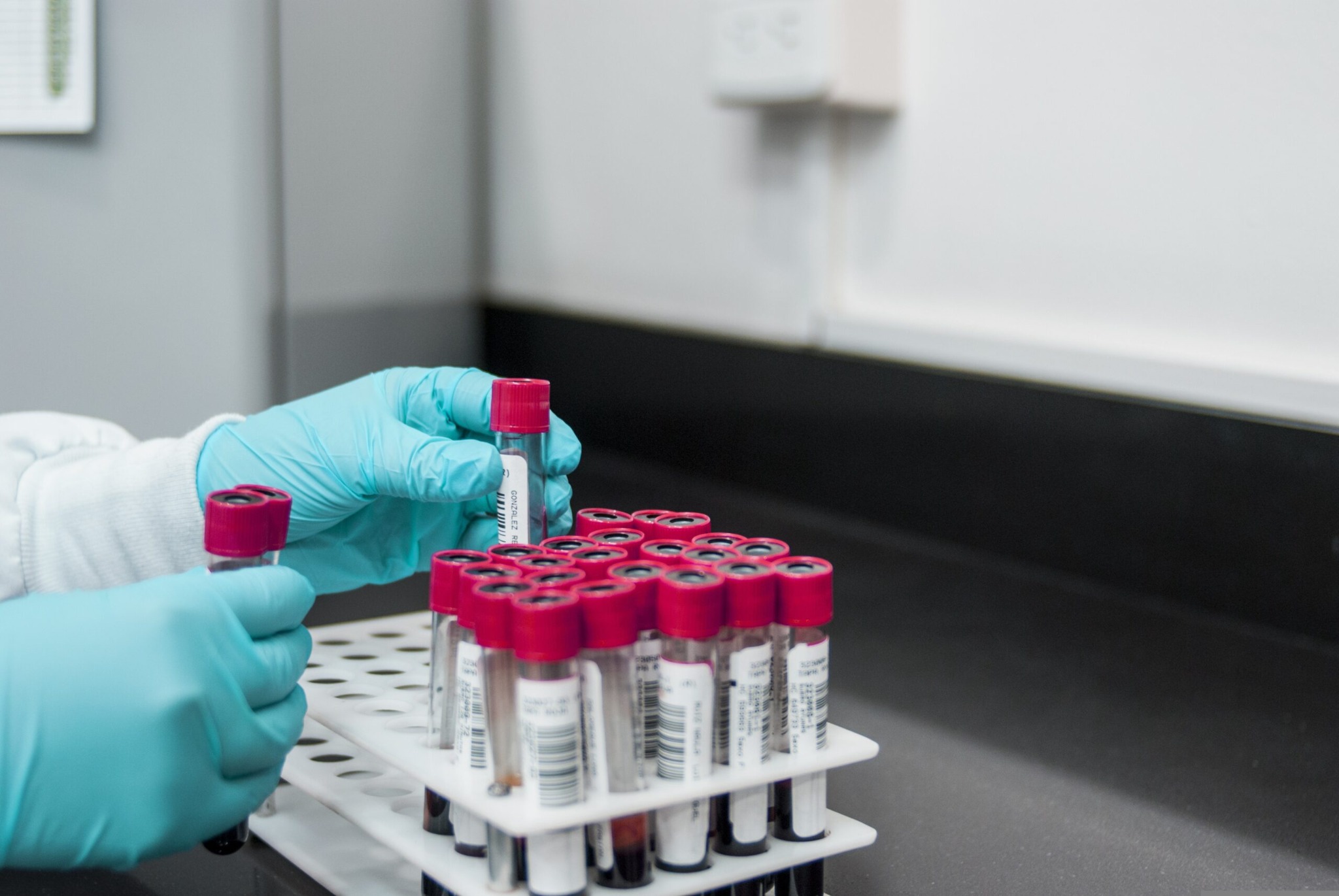 Servicio de laboratorio HMG
